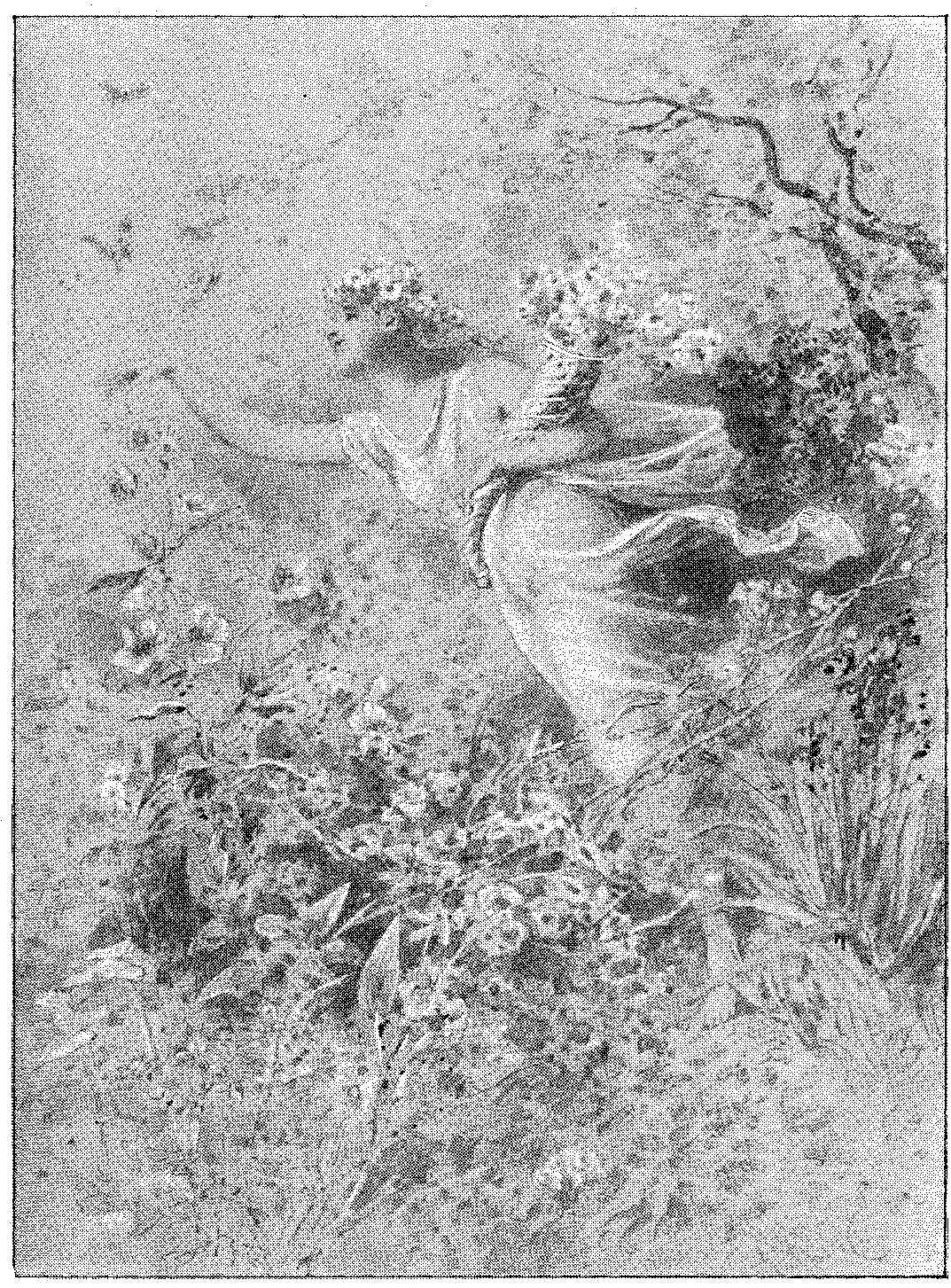 Vignette 6