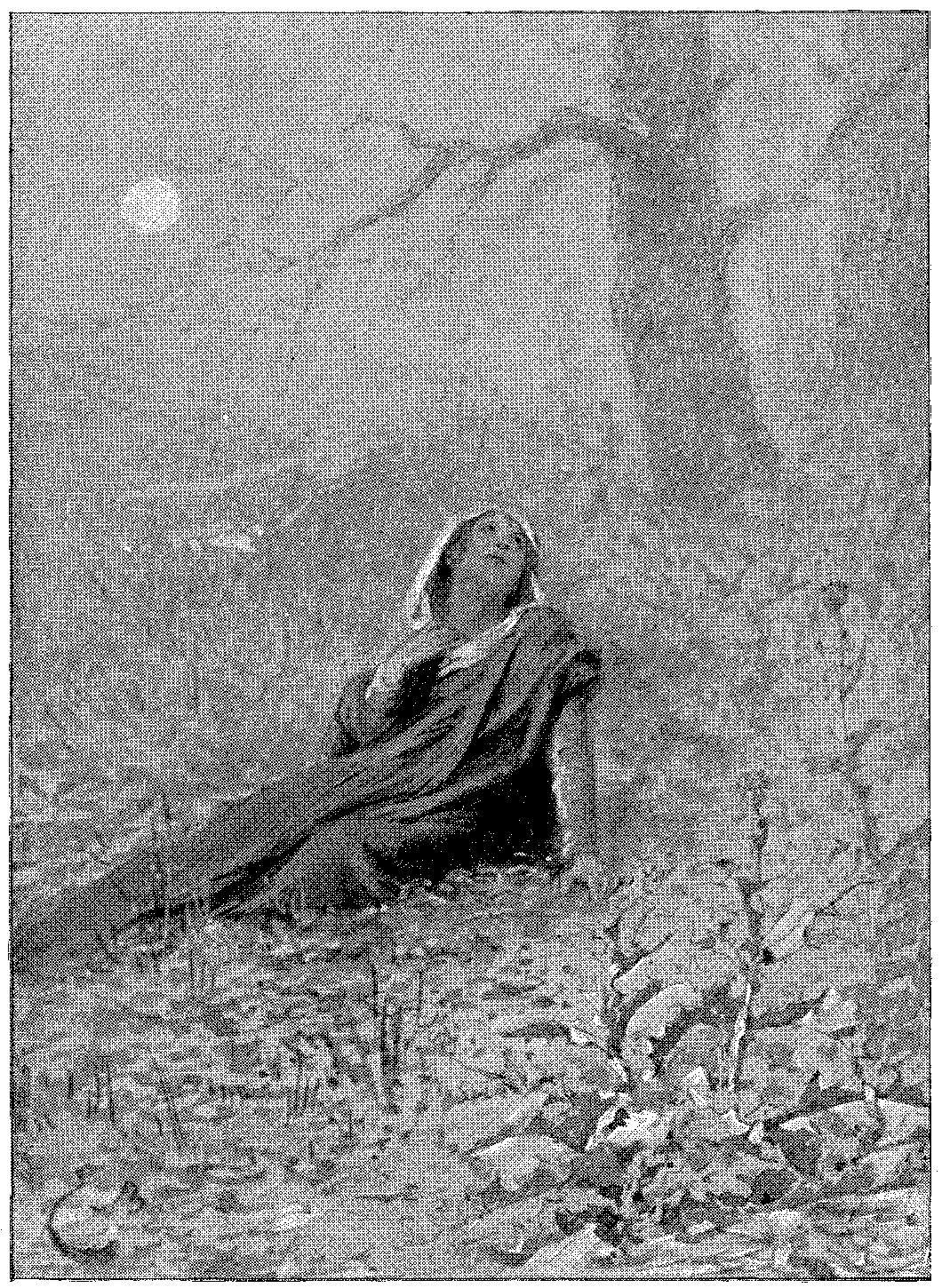 Vignette 11
