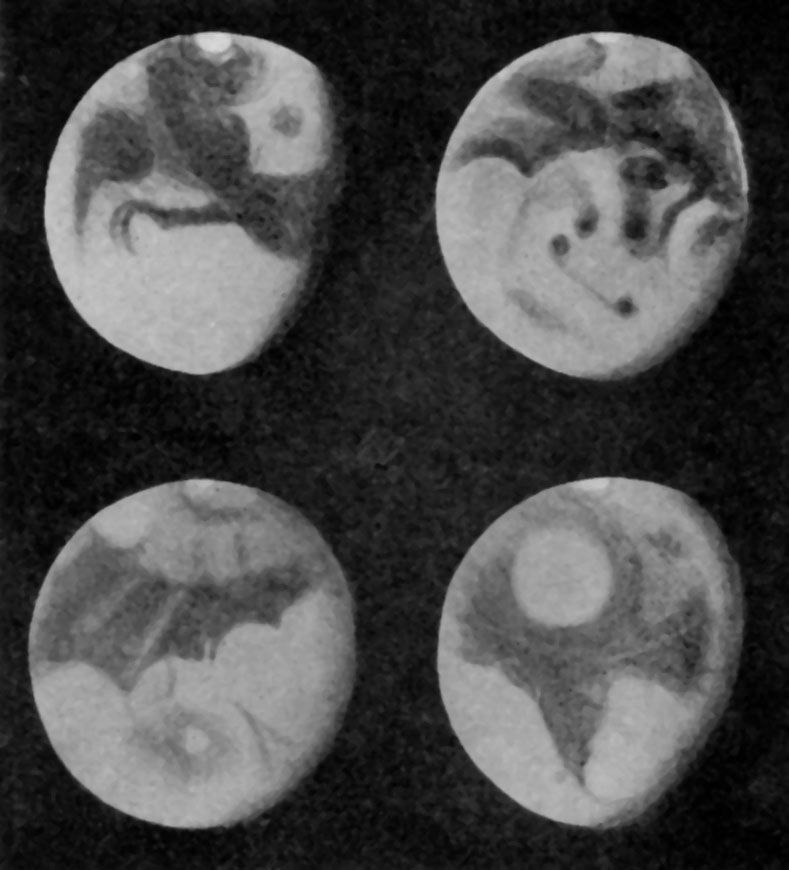Fig. 96.—Four views of Mars differing 90° in longitude.—Barnard.
