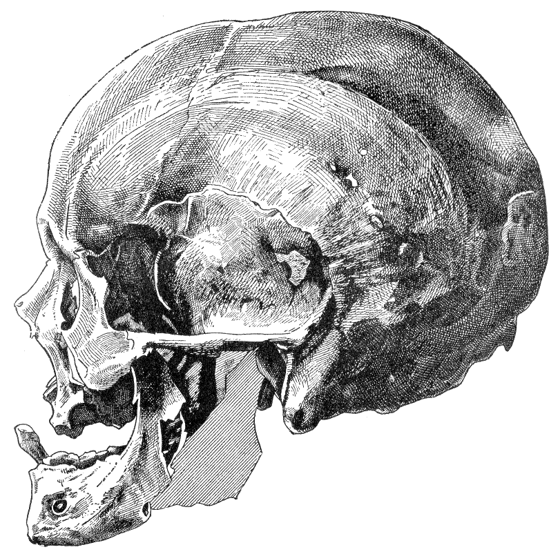 Fig. 281.