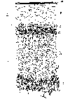 VERTICAL SECTION OF EPIDERMIS