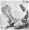 SECTION OF AN EPITHELIAL INGROWTH FROM AN EQUINE FOETUS