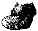 FOOT BADLY DEFORMED AS A RESULT OF CHRONIC LAMINITIS.