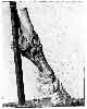 EFFECTS OF PERIOSTITIS ON THE PEDAL AND NAVICULAR BONES