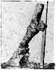 EFFECTS OF PERIOSTITIS ON THE PEDAL AND NAVICULAR BONES