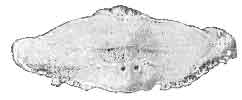 NAVICULAR BONE (POSTERO-INFERIOR SURFACE) SHOWING THE 'WORM-EATEN' APPEARANCE CAUSED BY EROSION OF THE HYALINE CARTILAGE, AND COMMENCING RAREFACTIVE ARTHRITIS.