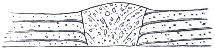 Neck filled with Volcanic Agglomerate Neck filled with Volcanic Agglomerate