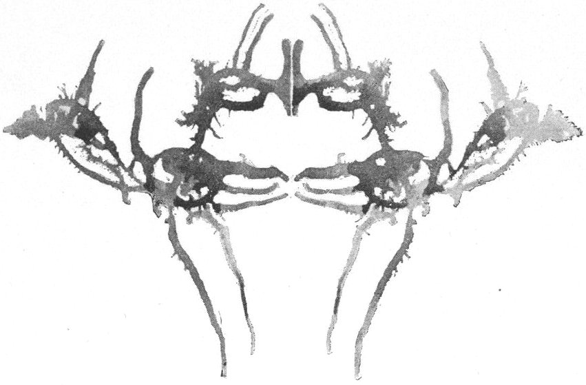In The X-Ray