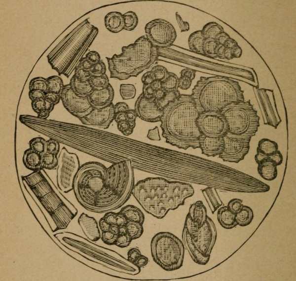 Magnified Chalk