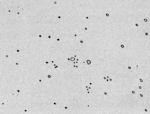 Splatter from a sneeze