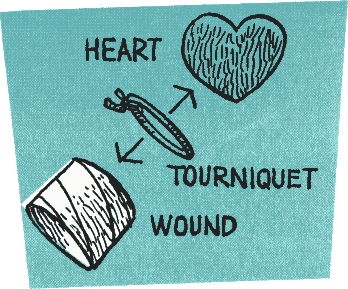 Illustration: 