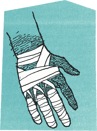 Illustration: 