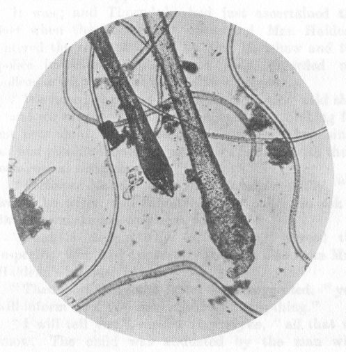 FLUFF FROM KEY-BARREL, MAGNIFIED 77 DIAMETERS.