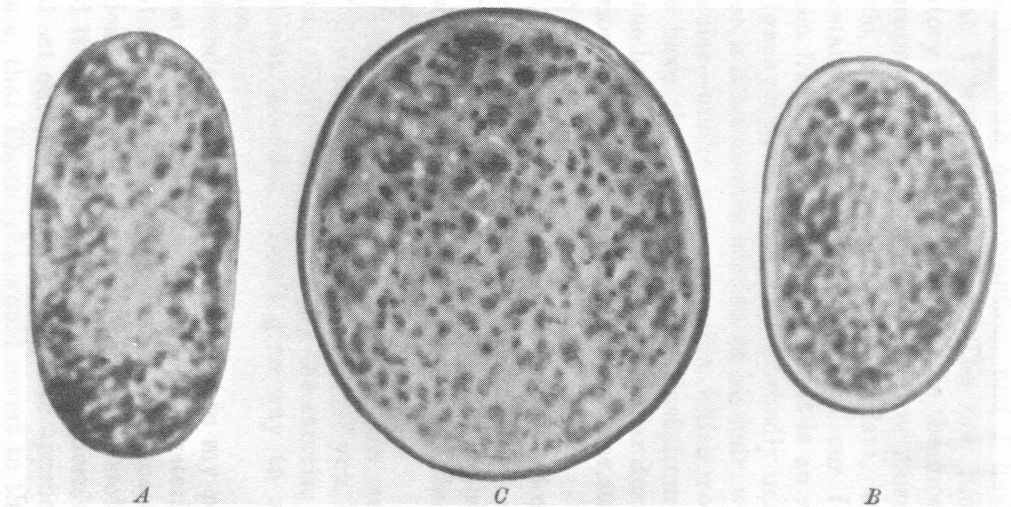 TRANSVERSE SECTIONS OF HUMAN HAIR: A, OF A NEGRO; B, OF AN ENGLISHMAN; C, OF THE BURGLAR. ALL MAGNIFIED 600 DIAMETERS.