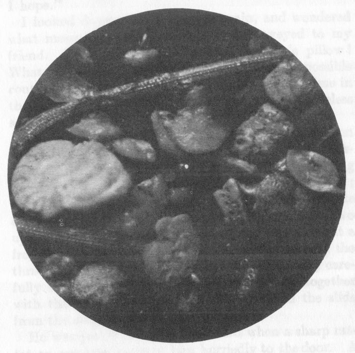 THE SAND FROM THE MURDERED WOMAN'S PILLOW, MAGNIFIED 25 DIAMETERS.