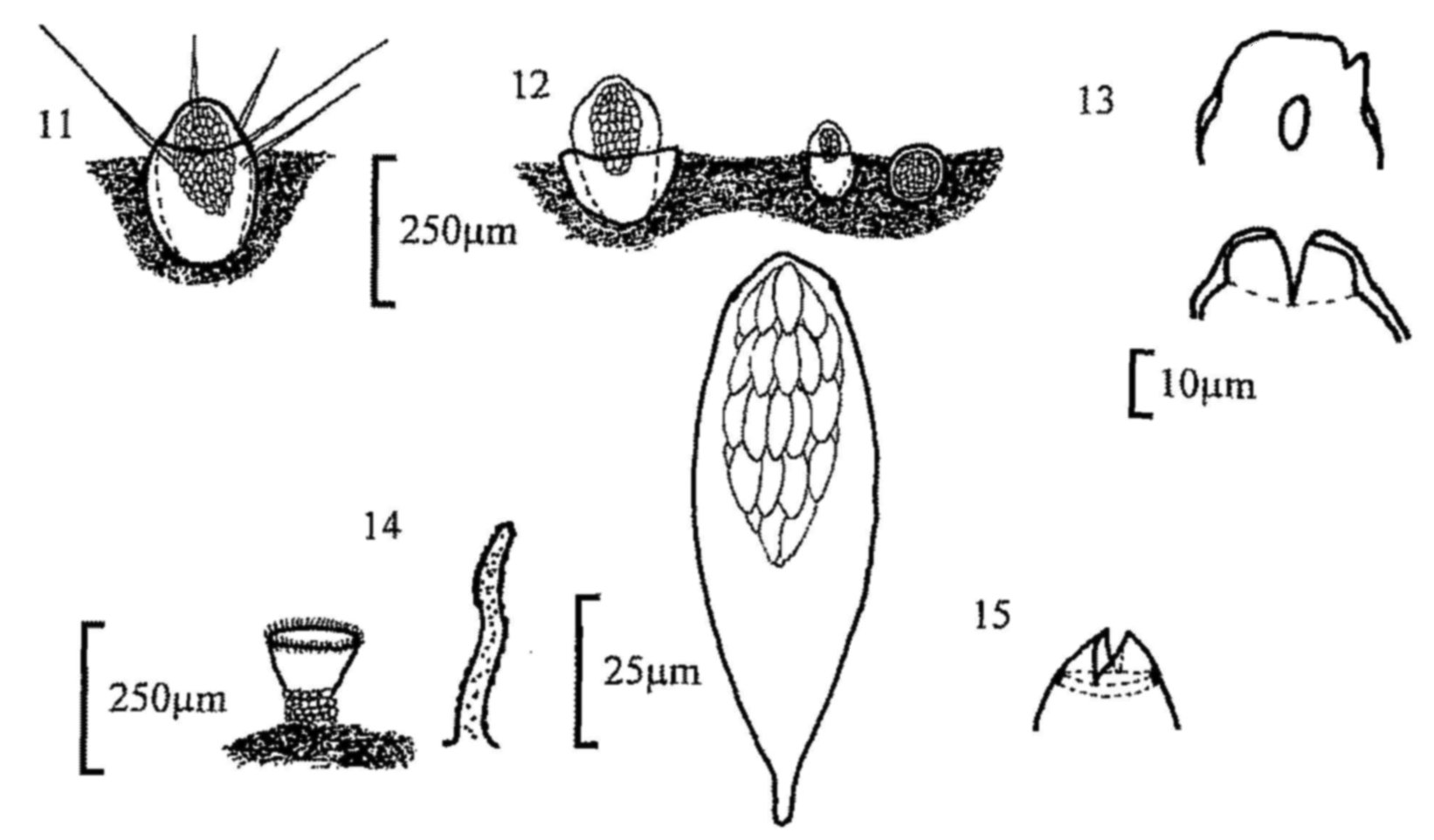 Figures 11-15
