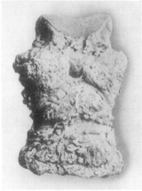 Fig. 17—Phalangeal exostoses. Fig. 17—Phalangeal exostoses.