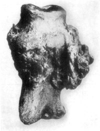 Fig. 19—Phalangeal exostoses in chronic ringbone. Museum specimen of the Kansas City Veterinary College. Fig. 19—Phalangeal exostoses in chronic ringbone. Museum specimen of the Kansas City Veterinary College.
