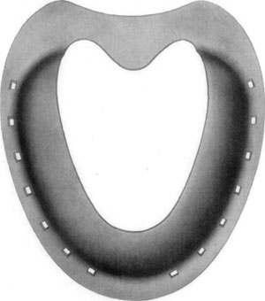 Fig. 36—Superior surface, showing concavity or bowl, as formed by the toe and branches of the shoe, as designed by Dr. David W. Cochran. Fig. 36—Superior surface, showing concavity or bowl, as formed by the toe and branches of the shoe, as designed by Dr. David W. Cochran.