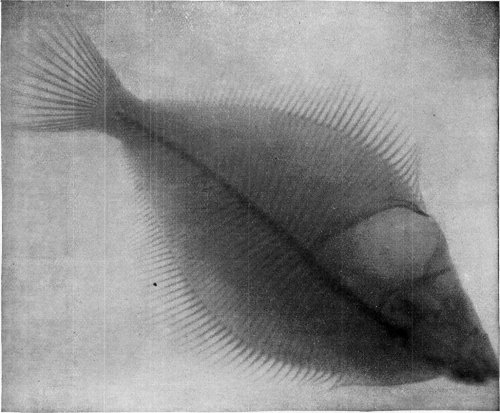 SKELETON OF A FISH PHOTOGRAPHED THROUGH THE FLESH.