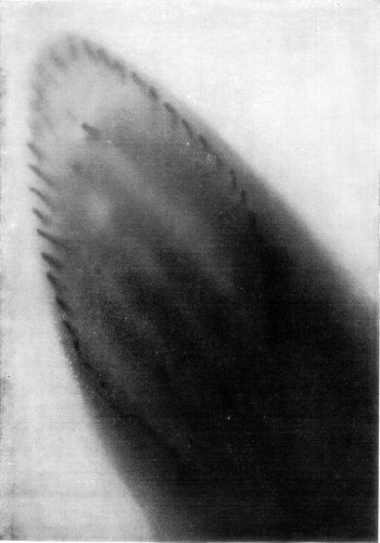 A HUMAN FOOT PHOTOGRAPHED THROUGH THE SOLE OF A SHOE. THE SHADING SHOWS THE PEGS OF THE SHOE, AS WELL AS TRACES OF THE FOOT.