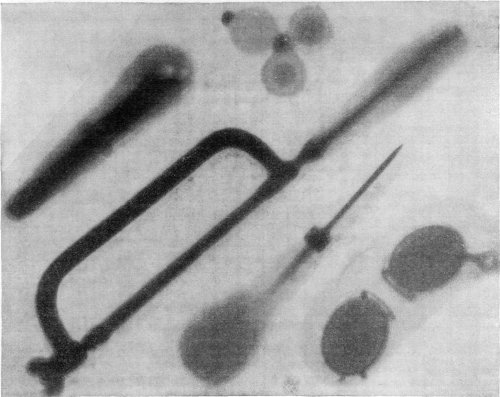 A GROUP OF FAMILIAR ARTICLES UNDER THE RÖNTGEN RAYS.