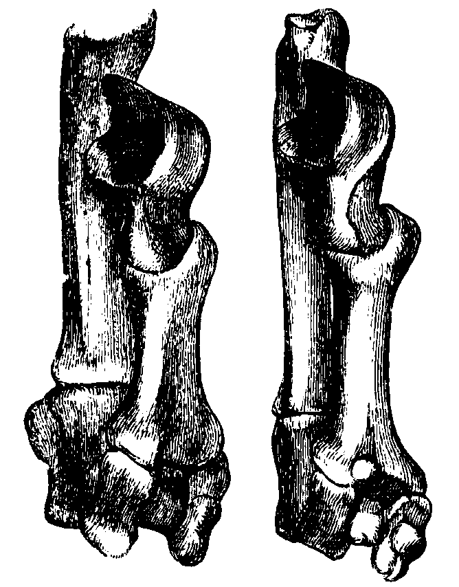 Tarsal bones of different Lemuroids. Tarsal bones of different Lemuroids.