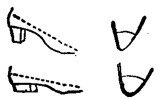 Fig. 107—Heels and toes of unhygienic and of hygienic footwear. Fig. 107