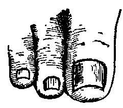 Fig. 124—Proper method of trimming nails of toes. Fig. 124