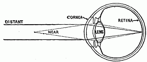 Fig. 161—Diagram showing changes in shape of crystalline lens to adapt it to near and distant vision. Fig. 161
