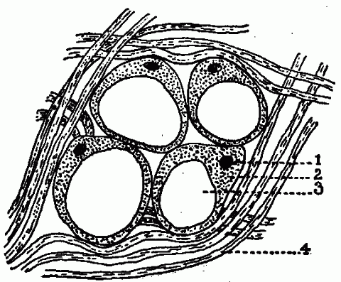Fig. 79—Stored-up fat. The figure shows four connective tissue cells containing small particles of fat. 1. Nucleus. 2. Protoplasm. 3. Fat. 4. Connective tissue fibers. Fig. 79