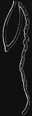 Fig. 114. Medusa with a simple thread-like tentacle. Fig. 114. Medusa with a simple thread-like tentacle.