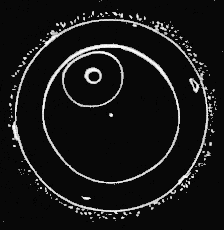 Fig. 155. Egg of Star-fish. Fig. 155. Egg of Star-fish.