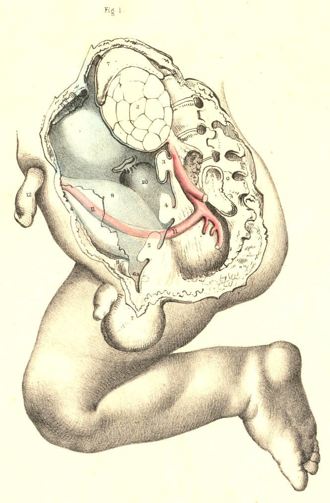 Illustration: