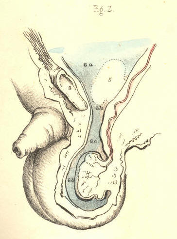 Illustration: