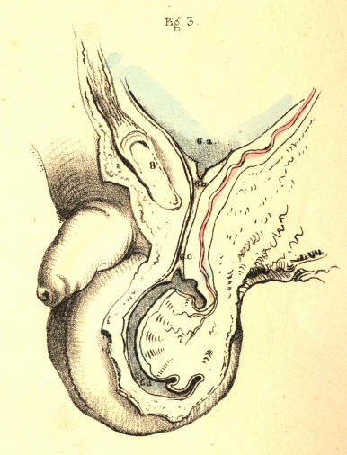 Illustration: