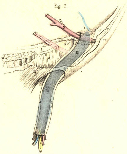 Illustration: