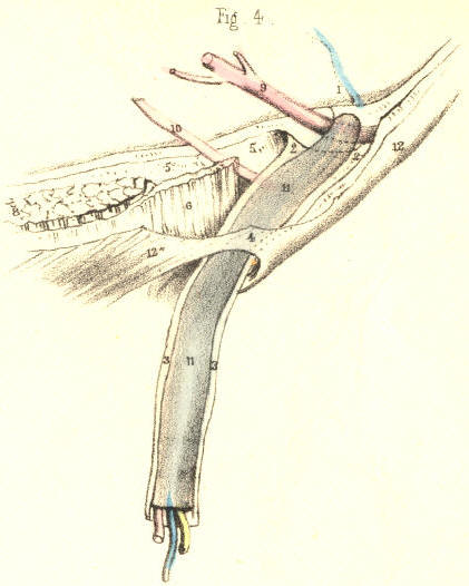Illustration: