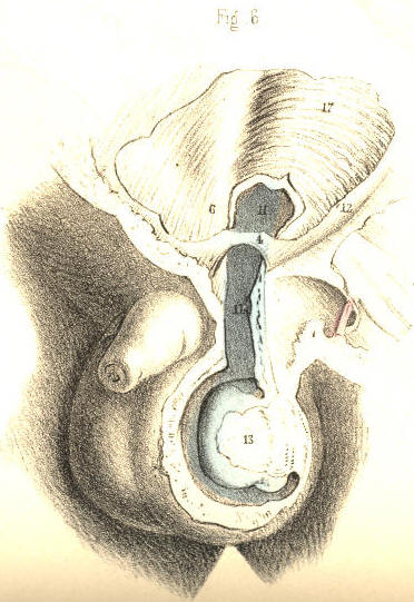 Illustration: