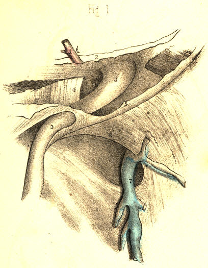 Illustration: