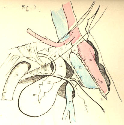 Illustration: