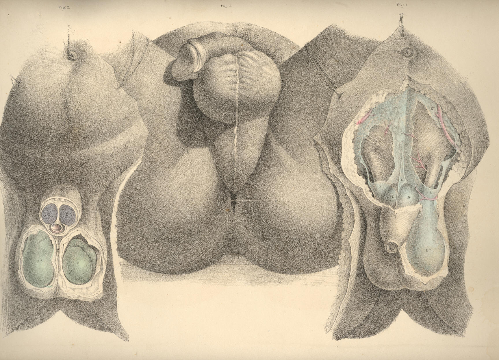 Illustration: