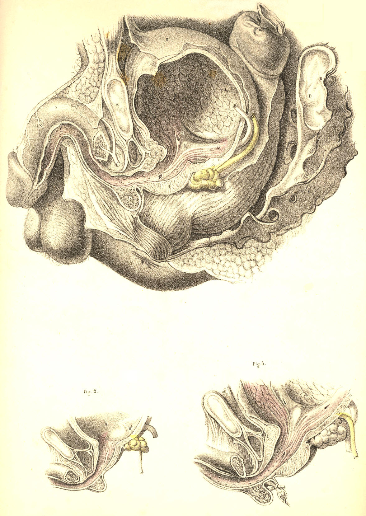 Illustration: