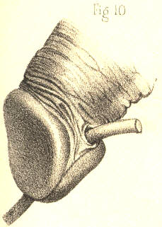 Illustration: