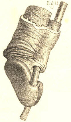 Illustration: