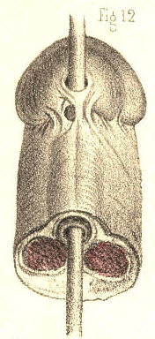 Illustration: