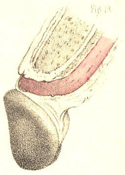 Illustration: