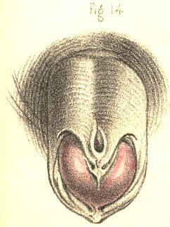 Illustration: