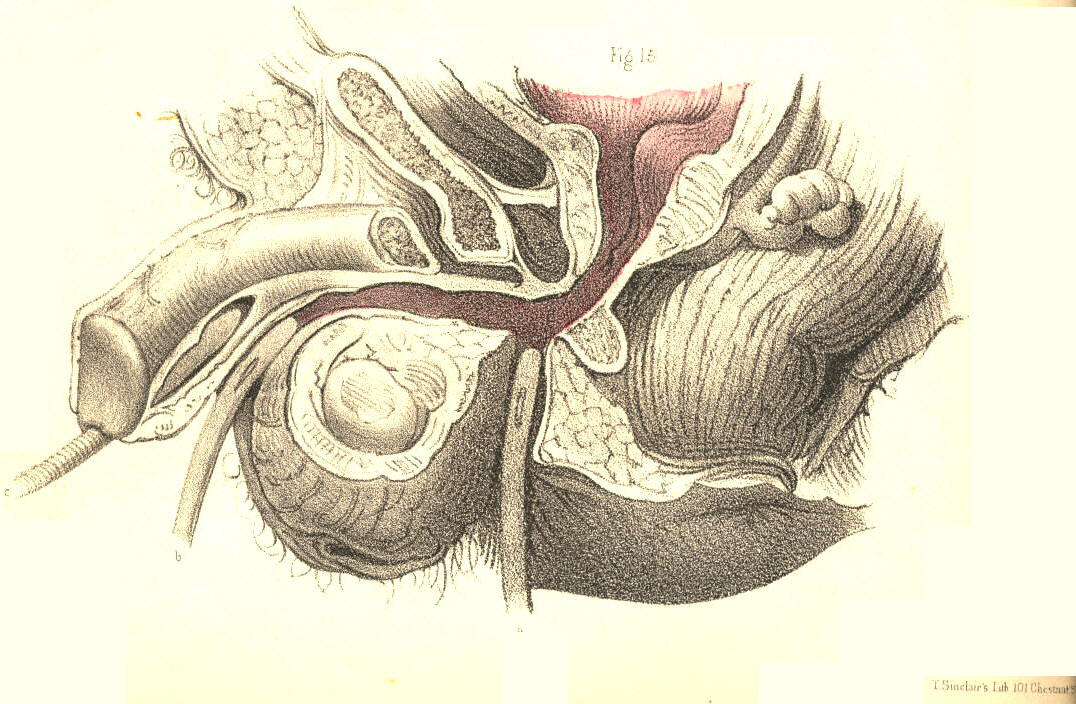 Illustration: