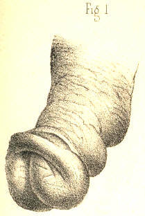 Illustration: